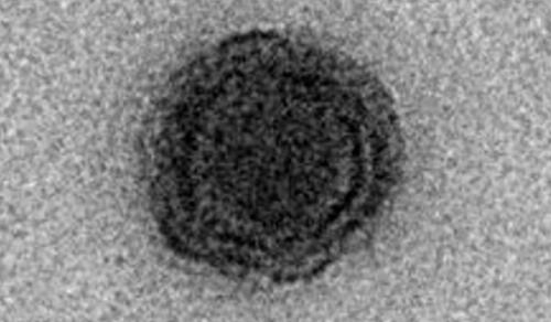 Imagen captada de un virión de Yaravirus aislado. Fuente: BioRXiv. Imagen captada de un virión de Yaravirus aislado. Fuente: BioRXiv.