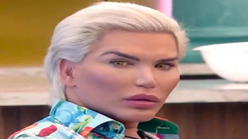 Más de 70 cirugías se realizó Rodrigo Alves para lograr convertirse en un 'Ken de la vida real'