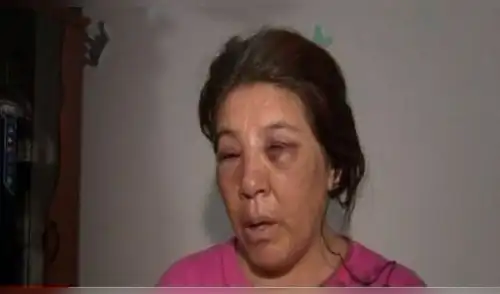 VMT: Mototaxista que desfiguró rostro a su ex pareja podría salir libre [VIDEO]