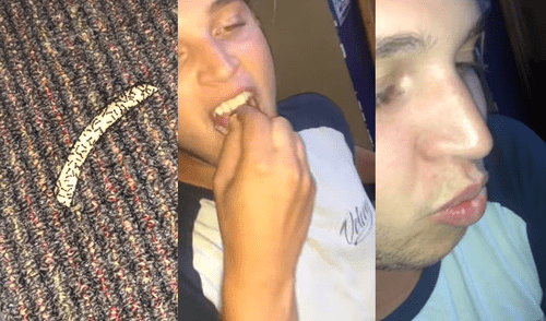 YouTube: lo retan a comer papa frita llena de hormigas, él acepta y luego reacciona así [VIDEO]