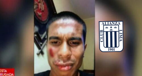 Alianza Lima se pronuncia sobre la salvaje agresión contra José Marina