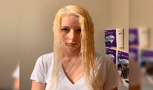 Facebook: Así quedó una joven que intentó decolorarse el cabello con lejía [FOTOS]