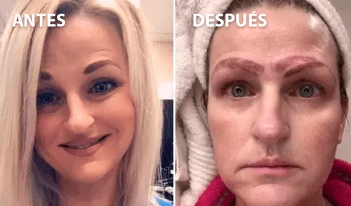 Facebook viral: así quedó una mujer que se sometió a un tratamiento de tatuaje de cejas [VIDEO]