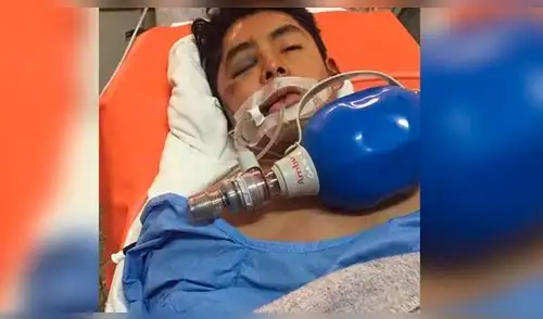 Buscan identificar a joven que murió tras caer violentamente de mototaxi en Arequipa 