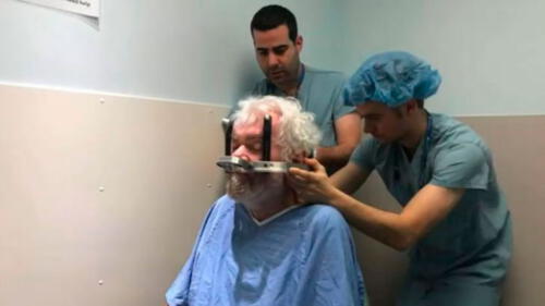 Frank Plummer fue sometido a una estimulación cerebral profunda para superar su problema de alcoholismo. Foto: Difusión Frank Plummer fue sometido a una estimulación cerebral profunda para superar su problema de alcoholismo. Foto: Difusión