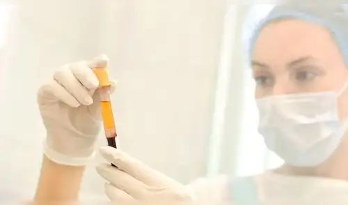 El Instituto Mexicano del Seguro Social ha invitado a los ciudadanos a donar plasma. Foto: Difusión.