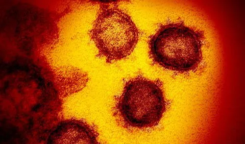 El periodo de incubación del nuevo coronavirus varía entre 2 y 14 días | Foto: AP / NIAID