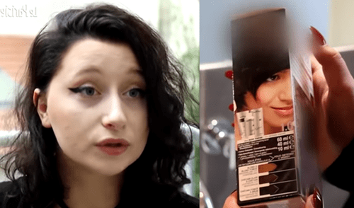 Facebook: chica acaba con la cara hinchada, porque se pintó el pelo y era alérgica al tinte [VIDEO]