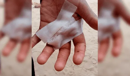 Víctima logró desviar dirección de la bala con su mano.