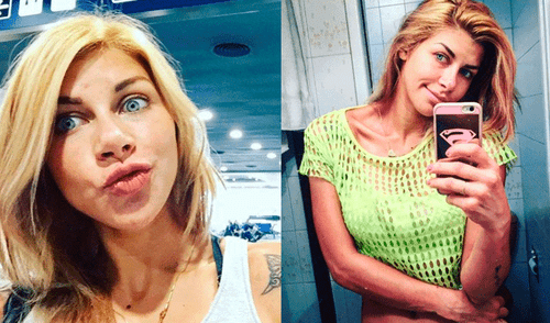 Xoana González comparte foto del antes y después de su operación de senos