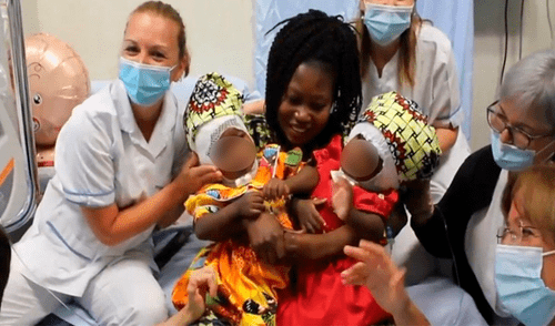 Las niñas tendrán la oportunidad de crecer y llevar una vida normal. (Foto: La Vanguardia) Italia – Vaticano – siamesas – operación – bebé