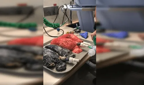 Vídeo viral de los pulmones sanos vs los de un fumador impacta en YouTube
