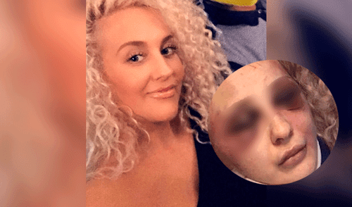 La víctima estuvo cuatro semanas en coma. La víctima estuvo cuatro semanas en coma.