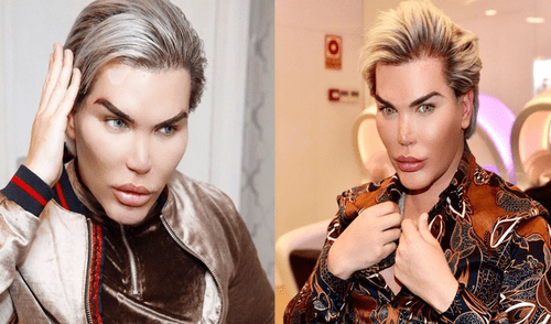Instagram: Ken humano se somete a su más dolorosa operación [FOTO]