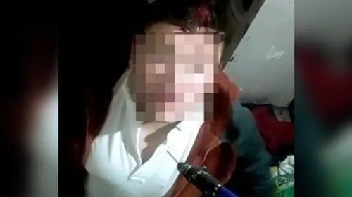 El reo, identificado con las siglas J.R.V. fue golpeado salvajemente por otros internos. Foto: Difusión El reo, identificado con las siglas J.R.V. fue golpeado salvajemente por otros internos. Foto: Difusión