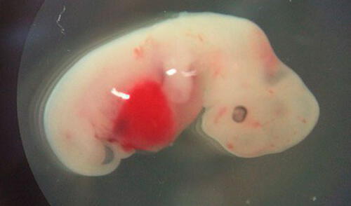 Científicos crearon el primer híbrido entre humano y cerdo | FOTOS