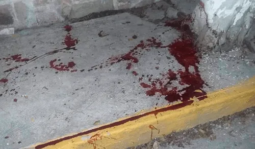 Vecinos hallan pulmones y vísceras humanas en lugar descampado [FOTOS]