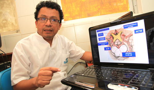 “Región Piura está en riesgo de brote de casos del síndrome Guillain Barré”   