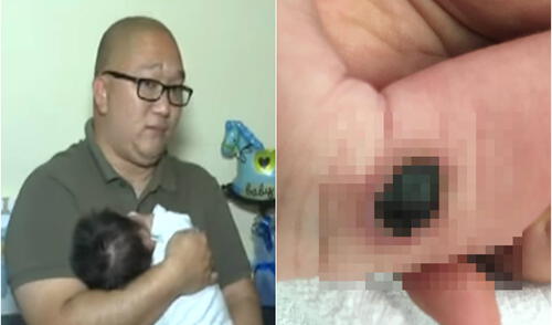 Padre denuncia negligencia en la clínica El Golf por quemadura en la pierna de su hijo [VIDEO]