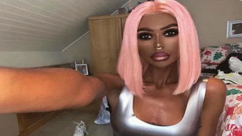 Joven se inyecta fármaco tres veces por semana para oscurecer su piel  [FOTOS]