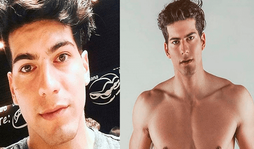 Ignacio Lastra reaparece tras quemarse el 90% del cuerpo: "Esta es mi nueva cara"