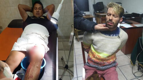 Detienen a colombiano por acuchillar a policía en Arequipa Detienen a colombiano por acuchillar a policía en Arequipa