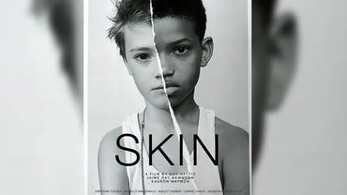 Skin se lleva la estatuilla como mejor cortometraje en los Oscar 2019 Skin se lleva la estatuilla como mejor cortometraje en los Oscar 2019