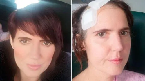 La mujer se encontraba embarazada cuando le indicaron que tenía una infección. (Foto: Facebook) La mujer se encontraba embarazada cuando le indicaron que tenía una infección. (Foto: Facebook)