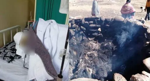 Niño que sobrevivió al incendio de su casa en Puno necesita ayuda económica. Niño que sobrevivió al incendio de su casa en Puno necesita ayuda económica.