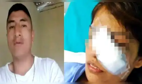 VMT: Sujeto que desfiguró a expareja la sigue acosando y amenazando de muerte