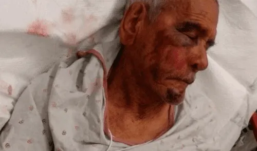 EE.UU.: Anciano de 92 años recibe brutal golpiza por ser mexicano EE.UU.: Anciano de 92 años recibe brutal golpiza por ser mexicano