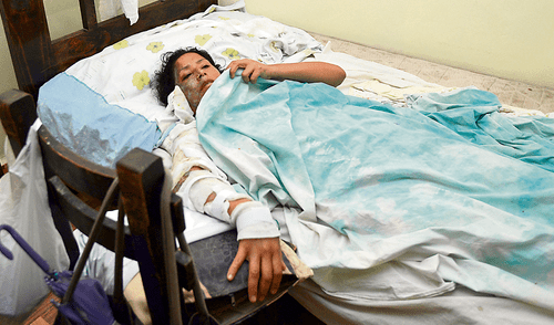 Hombre quema con agua hirviendo a exconviviente y a su propio hijo en SMP