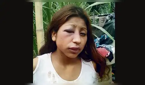 Lambayeque: sujetos casi matan a golpes a sus parejas sentimentales
