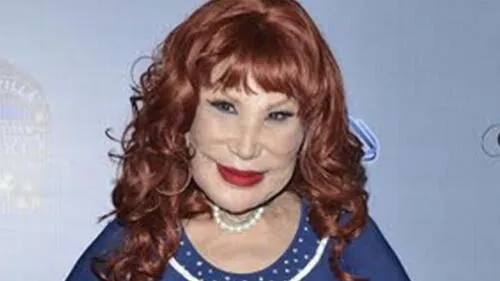 Lyn May muestra su nuevo rostro tras someterse a una cirugía estética [VIDEO]