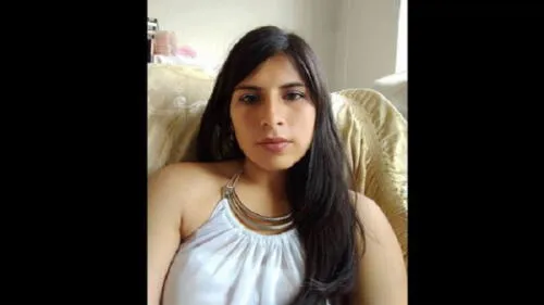 Eyvi Ágreda: médicos retirarán piel sana de joven para cubrir partes quemadas de su cuerpo Eyvi Ágreda: médicos retirarán piel sana de joven para cubrir partes quemadas de su cuerpo