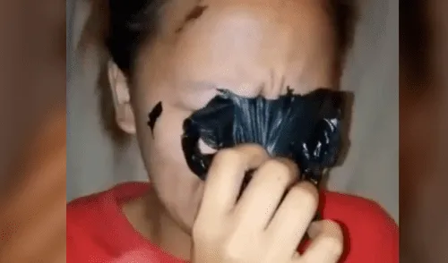 Facebook: muchacha asiática deseaba lucir como estrella K-Pop y se termina 'desfigurando' el rostro