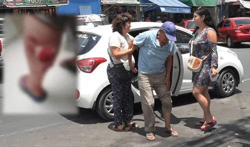 Anciano es nueva víctima de ataque de perro pitbull en Chimbote