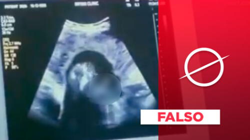 Imagen pertenece a una película producida por personas antiabortistas.