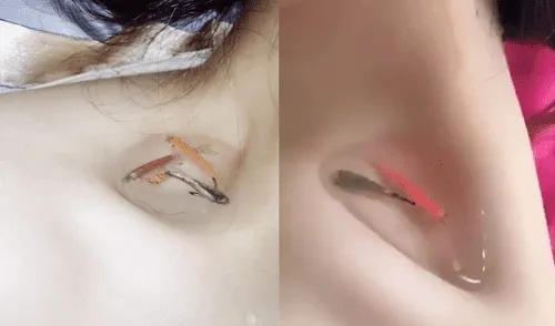 Facebook: el peligroso reto de colocarse peces en la clavícula para probar delgadez [VIDEO]
