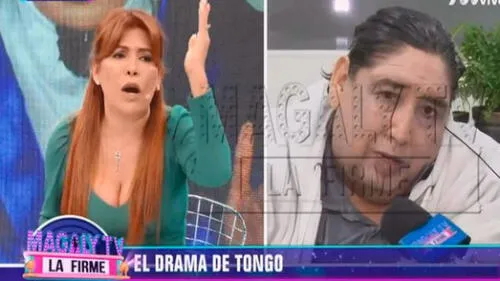 Gerente de seguro afirma que Tongo sí tiene SIS para tratamiento que necesita