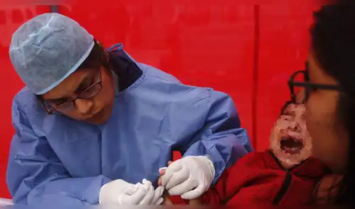 Minsa tratará contra la anemia a todos los niños menores de cinco años