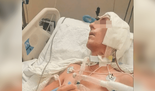 Hombre fue golpeado con un bate de béisbol en la cabeza durante un robo 