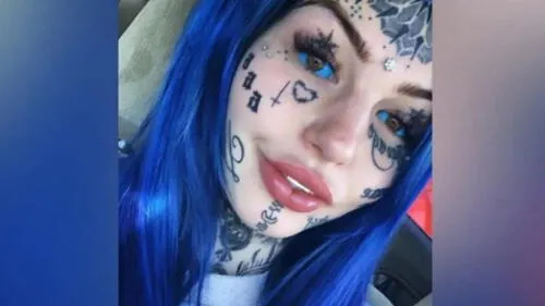 La joven quedó ciega por 21 días.