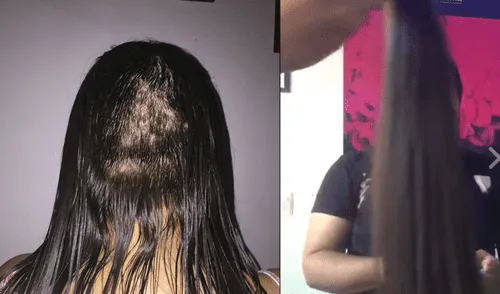 Facebook: solo quería un tratamiento capilar, pero le trasquilaron y robaron cabello [VIDEO]