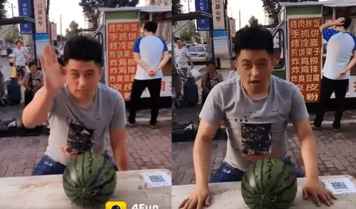 YouTube Viral: En el hospital terminó joven que quiso romper sandía con la cabeza [VIDEO]