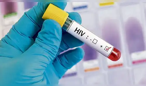 Células madre, una esperanza para los pacientes con VIH