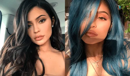 Instagram: Kylie Jenner y su excéntrico tratamiento de belleza 