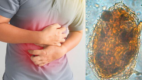 Advierten riesgo de contraer enfermedad, especialmente en verano. Foto: composición/La República