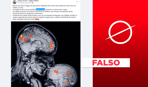 Es falso que la imagen muestra la oxitocina producida tras el beso de una madre. Foto: composición LR