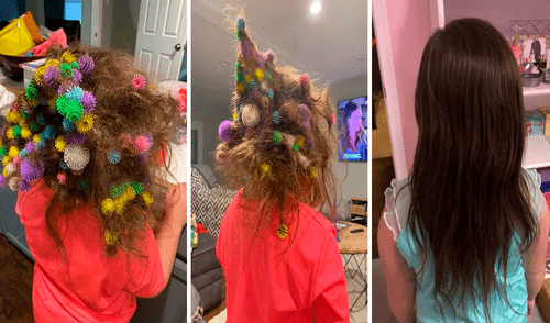 El hermano de la menor le lanzó un contenedor completo de juguetes con velcro que terminaron en el cabello de la niña. Foto: captura de Facebook de Lisa Hoelzle